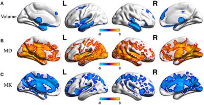 The Conjoint Analysis of Microstructural and Morphological Changes of Gray Matter During Aging